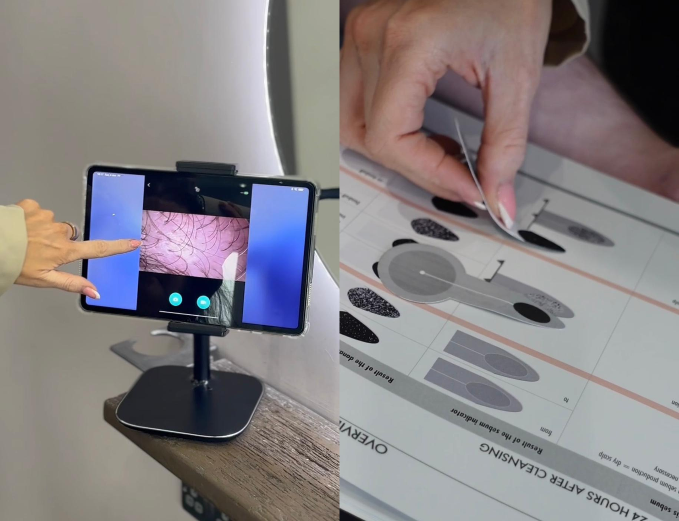 Scalp analysis Manchester