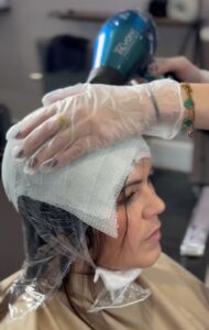 scalp casting